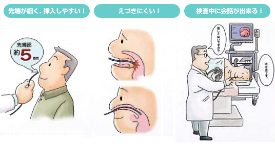 経鼻内視鏡のメリット　図